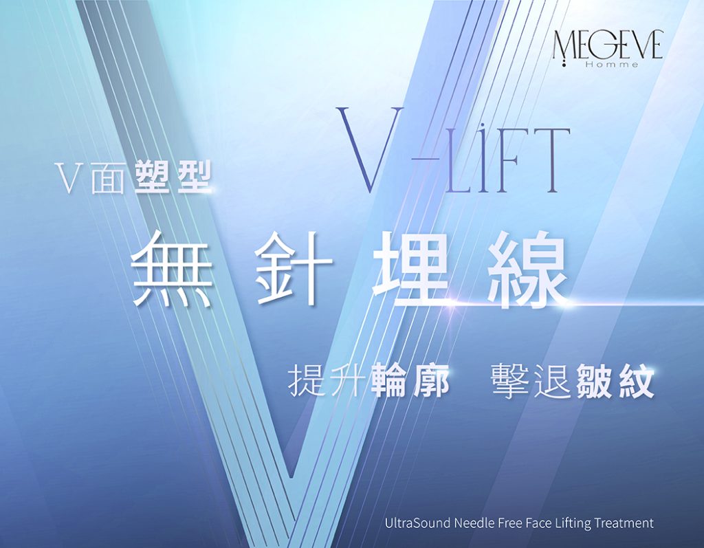 V面塑型
